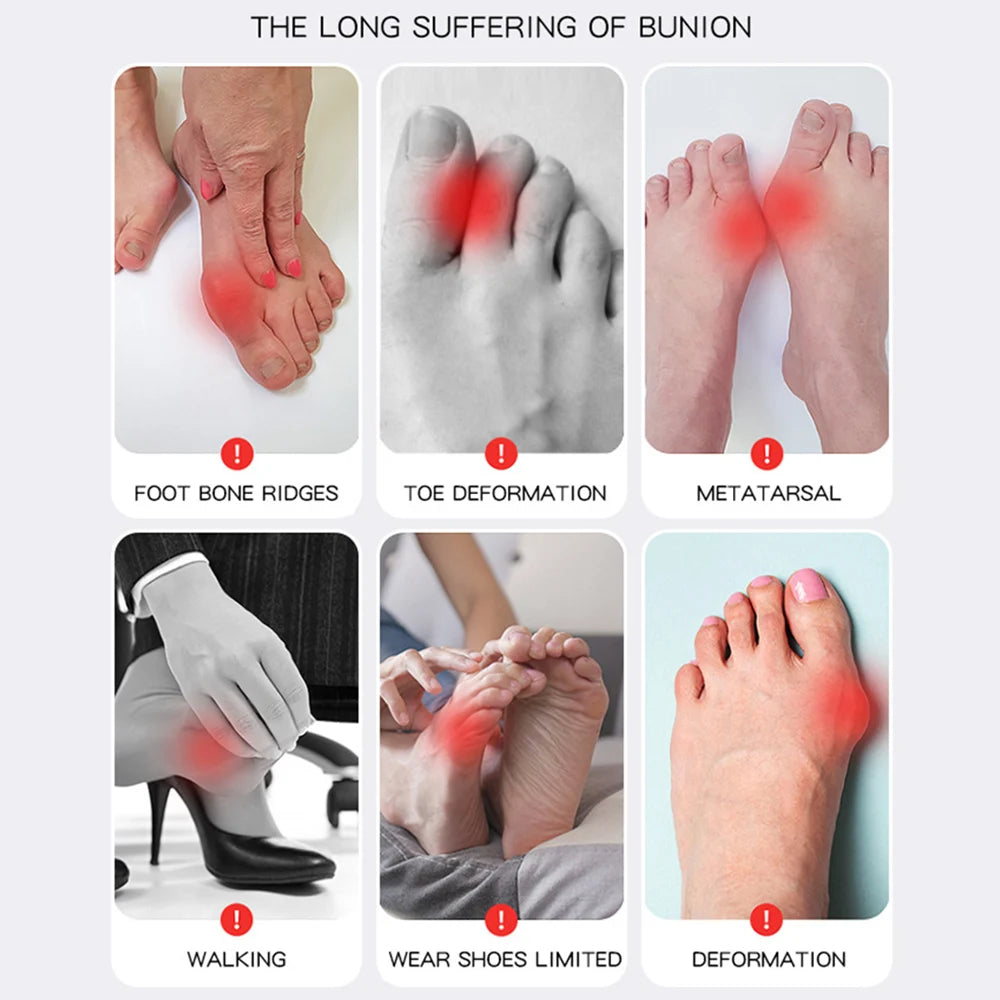 1PC Big Toe Bunion Corrector Adjustable Orthopedic Socks Toes Separator Pain Relief Hallux Valgus Feet Protector Foot Care Tools